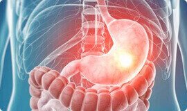Normaliza o funcionamento intestinal